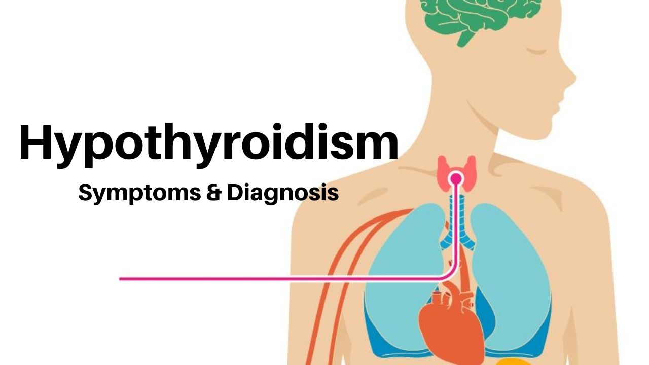 Signs and symptoms of hypothyroidism you should know about